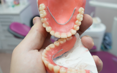 La limpieza con prótesis dentales